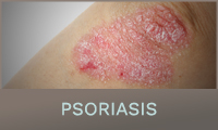 Psoriasis Psoriasis