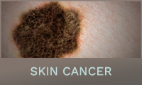 Skin Cancers Skin Cancers